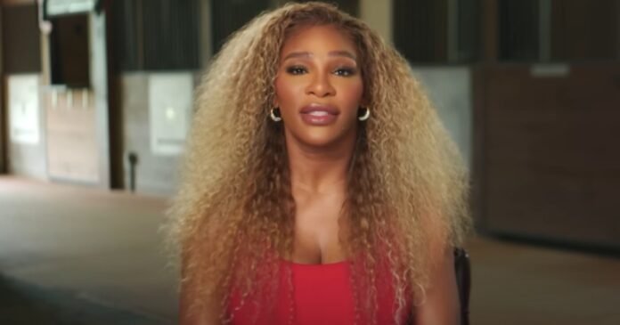 No, Serena Williams Did Not Bleach Her Skin